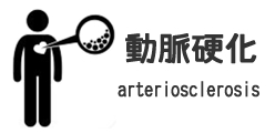 動脈硬化